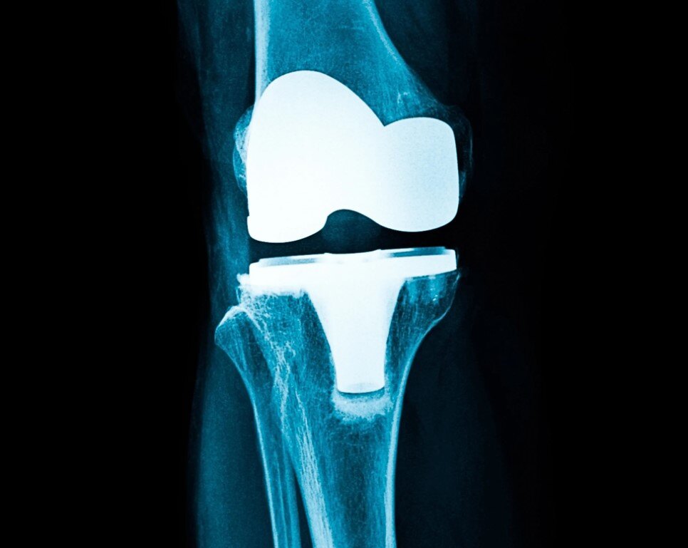 CNC Coolant for Medical Plastic Machining - UHMWPE & PEEK - Pure-Cut®