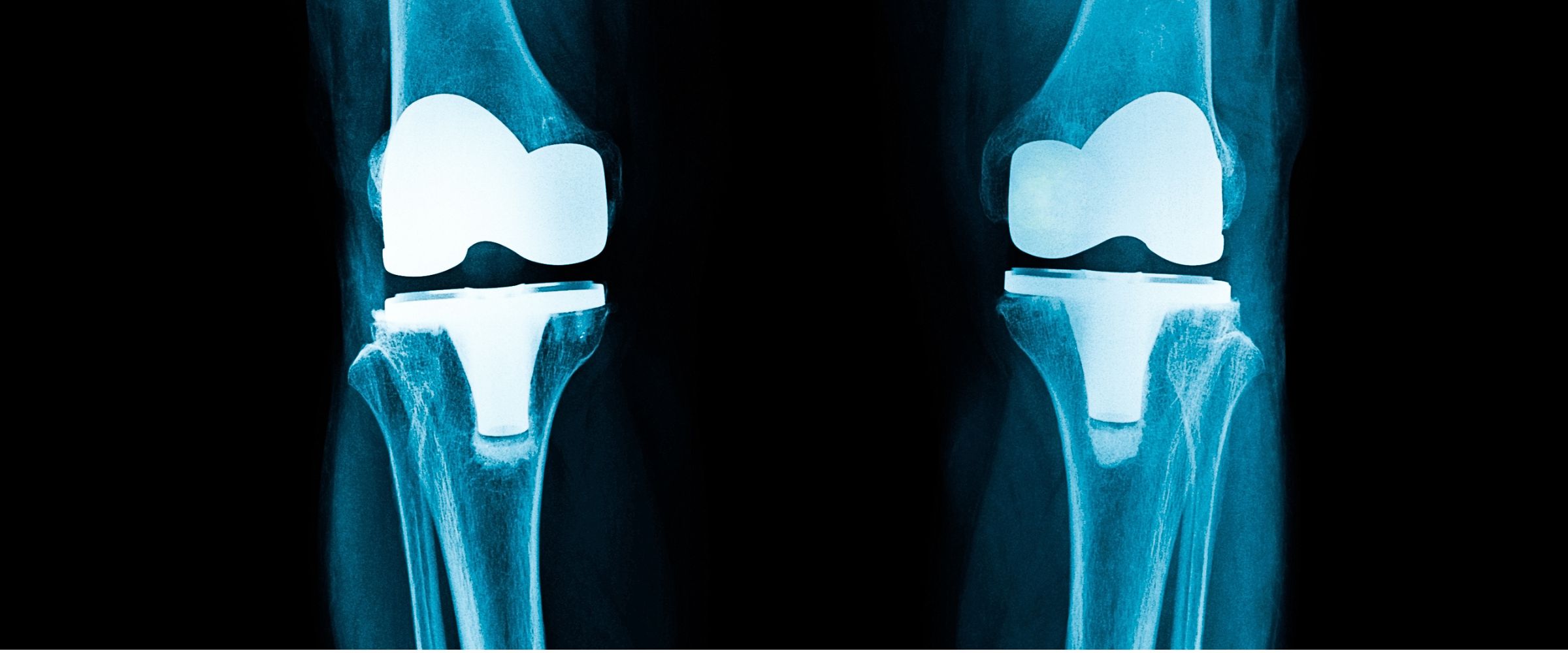 Medical-Machining-Solution-Fusion-Coolant-Systems-Pure-Cut Medical-Machining-Solution-Fusion-Coolant-Systems-Pure-Cut